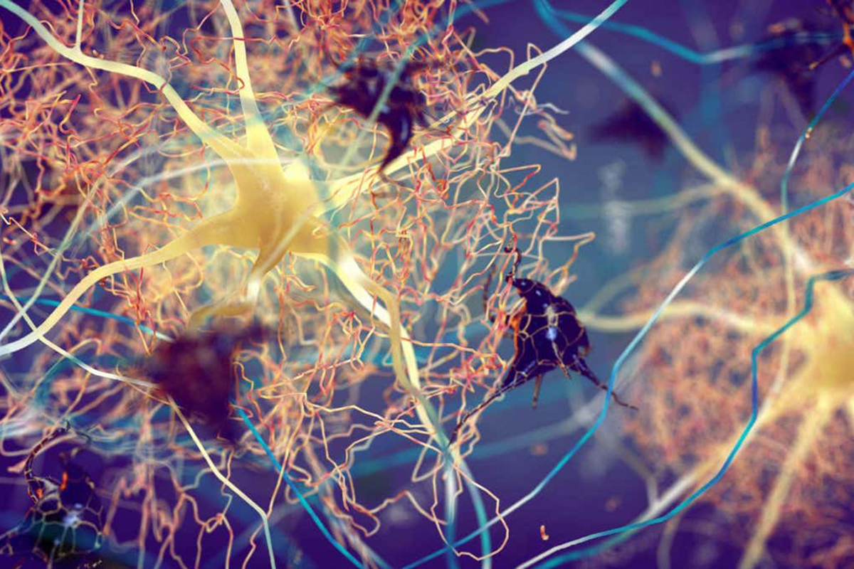 Un test da fare a casa potrebbe individuare l'Alzheimer