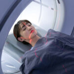 Un ictus può essere prevenuto nell'80% dei casi