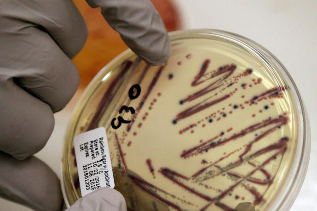 Minnesota e Wisconsin esortano a non consumare germogli di erba medica