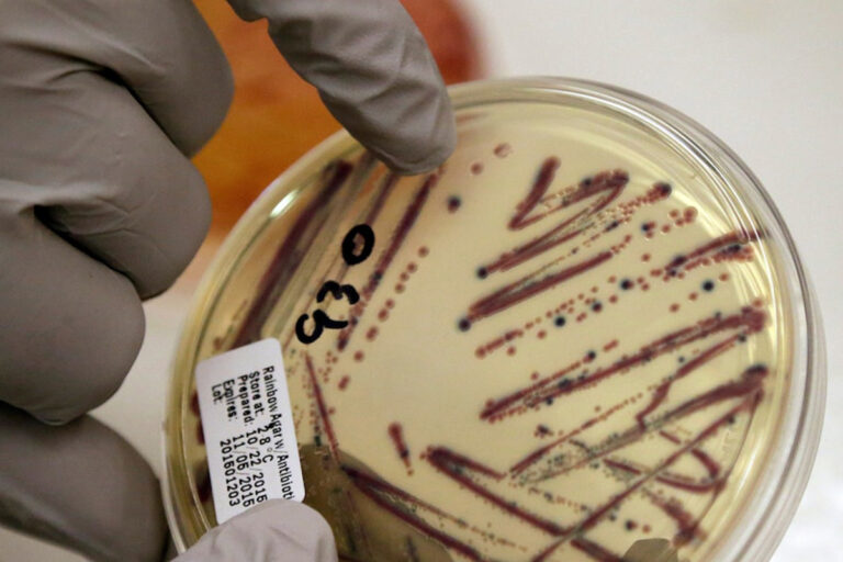 Minnesota e Wisconsin esortano a non consumare germogli di erba medica
